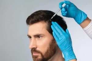 Hair Restoration by Oasis Med Spa & IV Bar in Meridian, ID