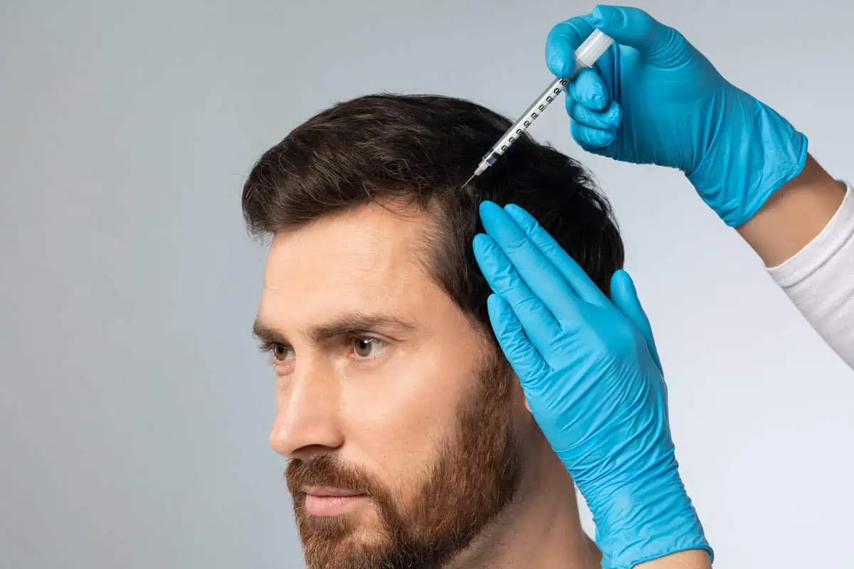 Is Hair Restoration the Best Solution for Thinning Hair?